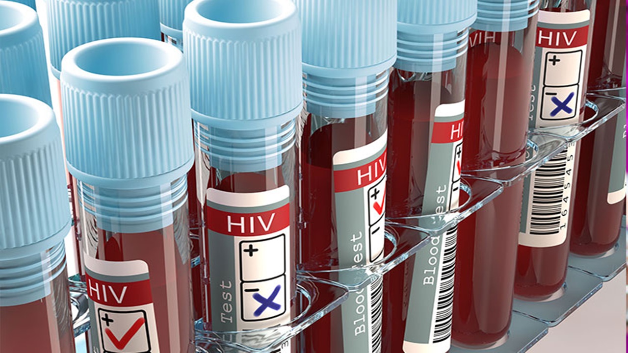 ABD’de 450 Hastaya Hepatit ve HIV Bulaş Riski